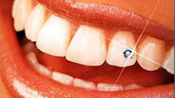 Estetska stomatologija