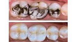 Konzervativna stomatologija