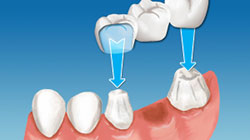 Stomatološka protetika